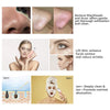 SkinPulse™ - Professional Ultrasound Skin Cleaning