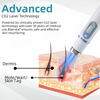 MoleGone® Non-Invasive Mole and Wart Removal Laser Pen Promax