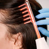 Carrie™ – High-Frequency Device for Radiant, Clear Skin