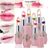 SoftLips™ – The Balm for Instant Moisture & Smoothness