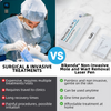 MoleGone® Non-Invasive Mole and Wart Removal Laser Pen Promax