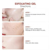 Feel™ – ClearSkin Exfoliating Gel (30-day Guarantee)