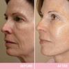 OUHOE™ | V-Face Lift Tape | Face Tightening Invisible Tape (40 pieces)