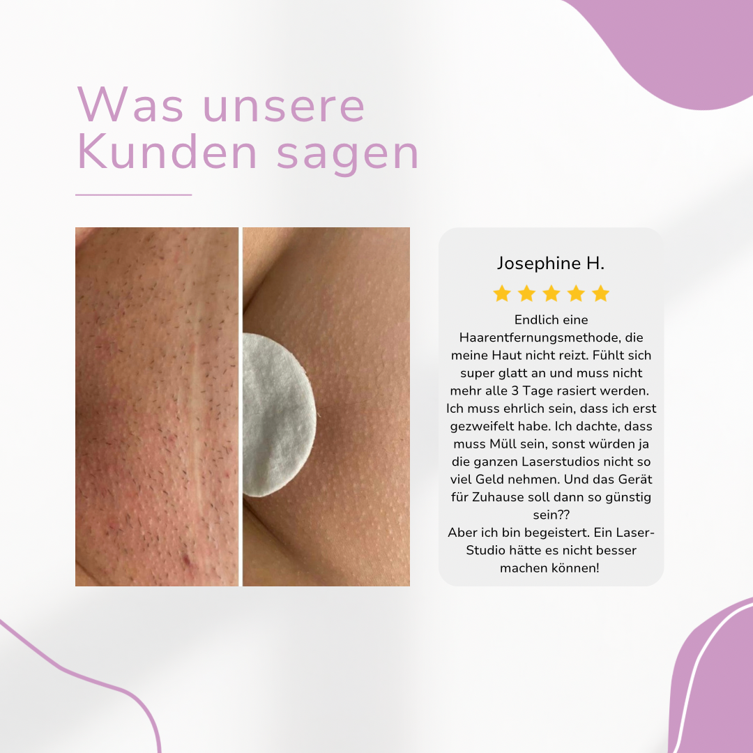 LaserTouch™ – Salon Quality for Your Home Hair Removal