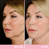 OUHOE™ | V-Face Lift Tape | Face Tightening Invisible Tape (40 pieces)