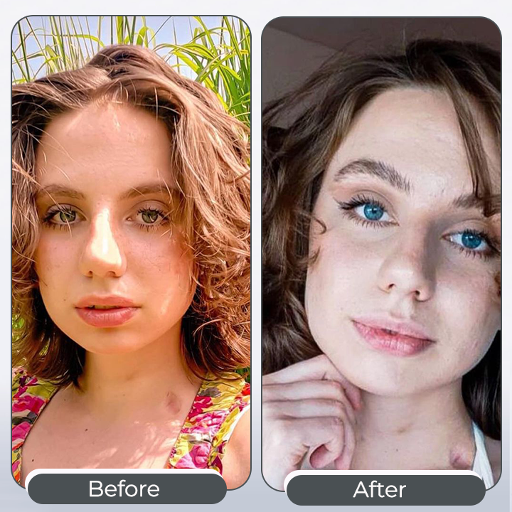 EyeCatcher™ Iris Color-Change Eye Drops