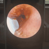 VisioEar Pro™ | Medically Certified Endoscope Ear Care with HD Camera