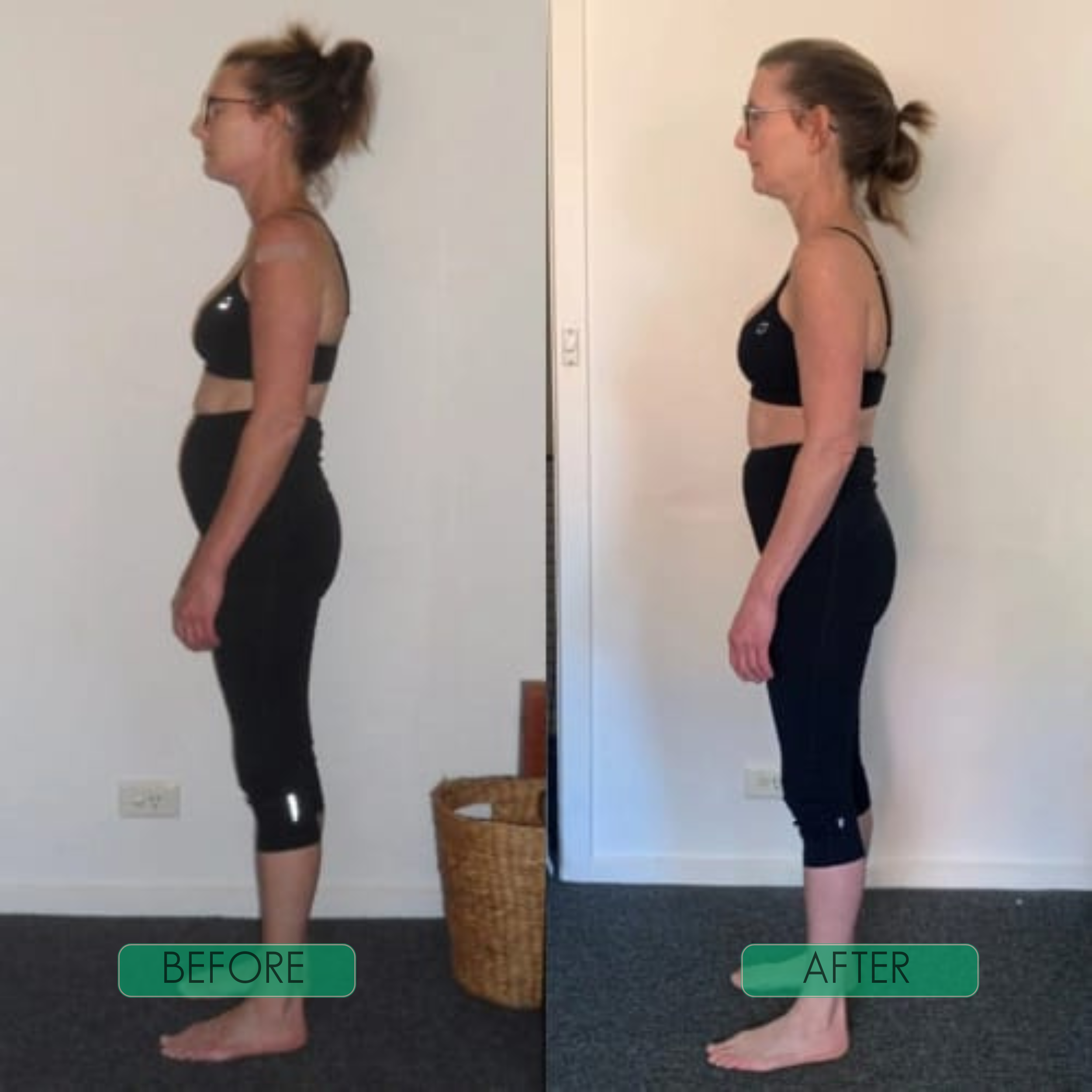 PosturaFlex™ | Immediate Posture Correction