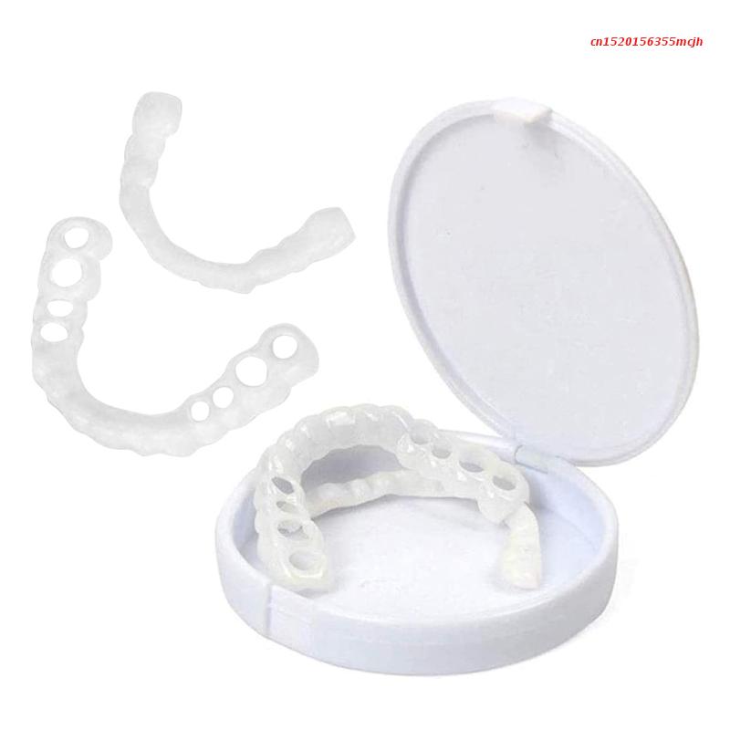 Snap-on Teeth™ - Always the Perfect Smile with These Veneers