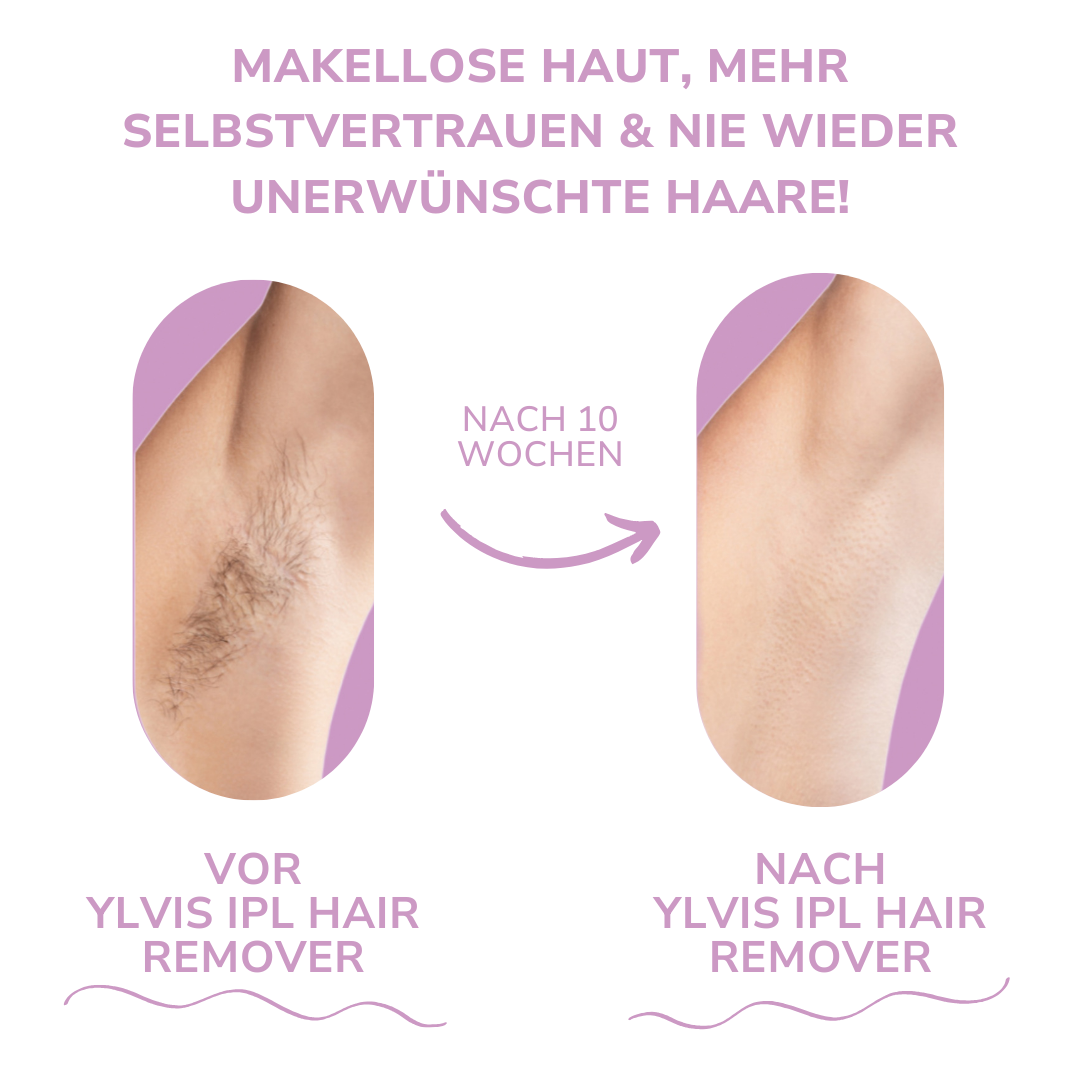 LaserTouch™ – Salon Quality for Your Home Hair Removal