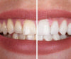 SmileKit™ | Feel More Confident with a Fresh and Radiant Smile That Lasts