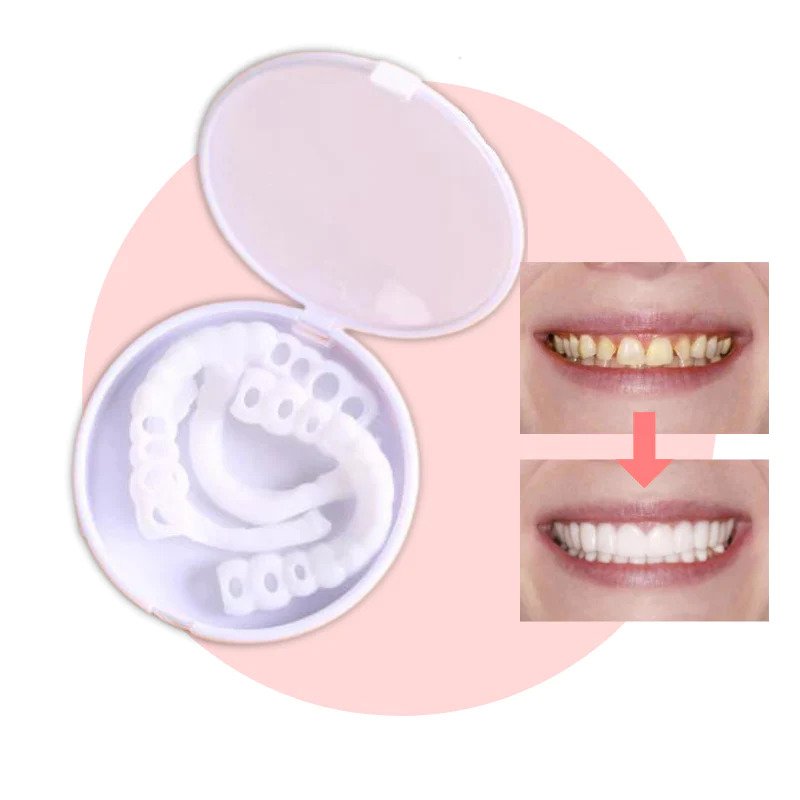 Snap-on Teeth™ - Always the Perfect Smile with These Veneers