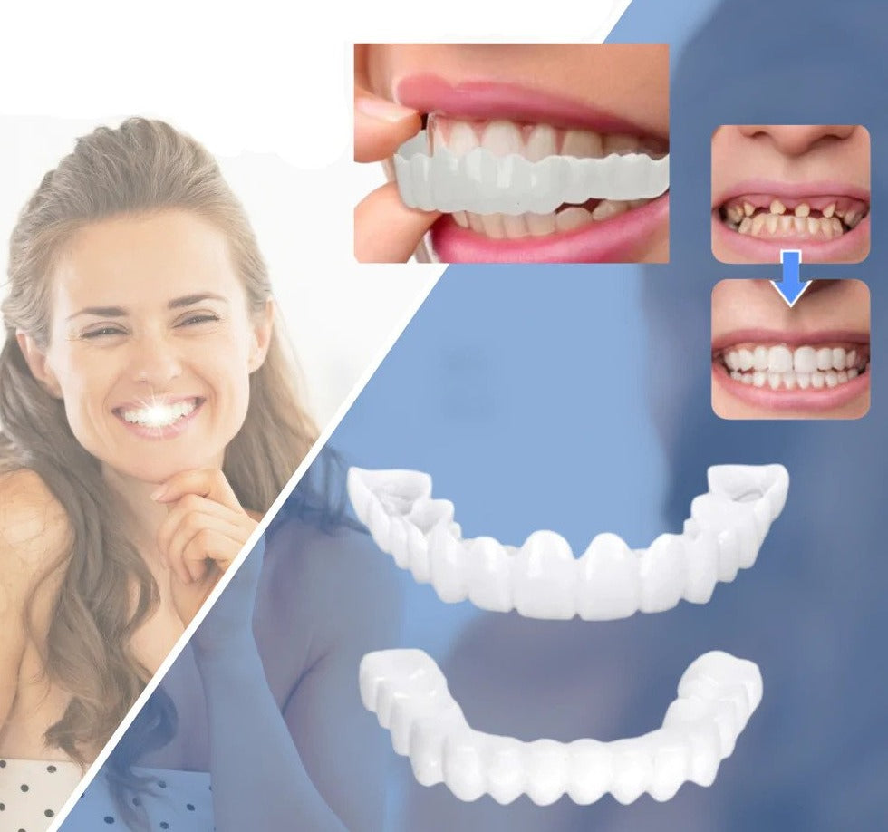 Snap-on Teeth™ - Always the Perfect Smile with These Veneers