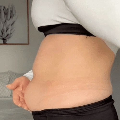 StickPatch™ | Instant Firming & Shine – Invisible Firming Patches