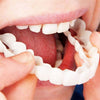 Snap-on Teeth™ - Always the Perfect Smile with These Veneers