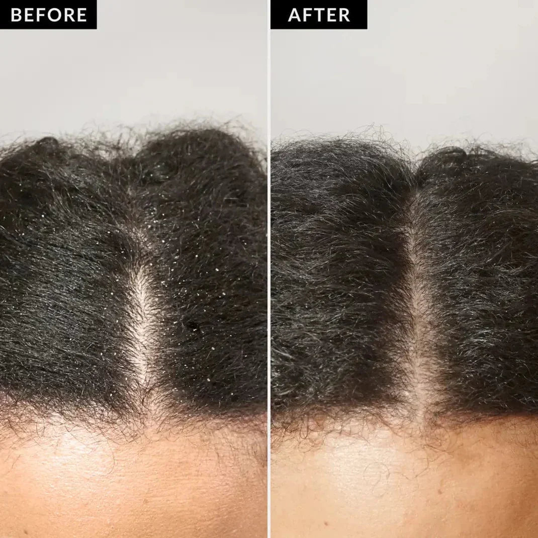 Clevia™ | Scalp Detox Comb